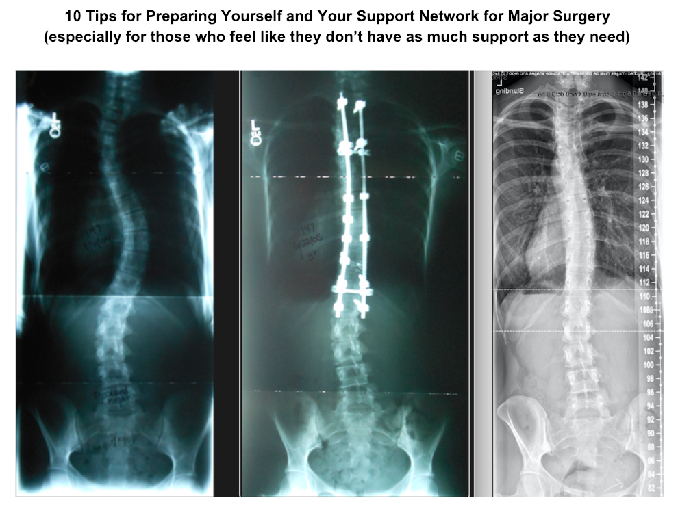 This image has an empty alt attribute; its file name is surgery-prep-guide.png